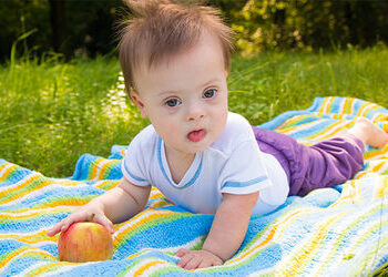 World Down Syndrome Day : દર વર્ષે 30 થી 35 હજાર બાળકો ડાઉન સિન્ડ્રોમ સાથે જન્મે છે | world down syn…