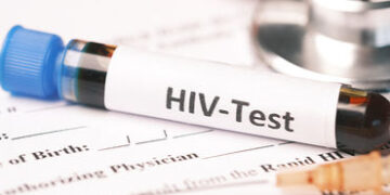 HIV ટેસ્ટ વગર નહીં થાય લગ્ન, ભારતની આ રાજ્યની સરકારનો મોટો નિર્ણય લેવાની તૈયારી | hiv test mandatory…