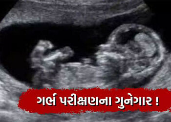 કેશોદમાં રહેણાંક મકાનમાંથી નોંધણી વગરનું સોનોગ્રાફી મશીન પકડાયું | Unregistered sonography machine s…