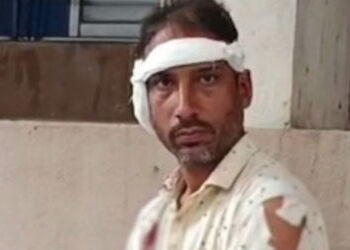 નવસારી: ભત્રીજાએ કાકાનો કાન બચકું ભરી છૂટો પાડ્યો, સર્જરી કરી જોડ્યો, આરોપીની ધરપકડ | Nephew bites u…