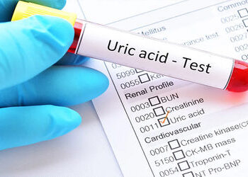 ભારતીય યુવાનોમાં યુરિક એસિડનું ચિંતાજનક પ્રમાણ ગંભીર બીમારીઓનું જોખમ વધારે છે