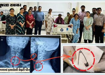 અમદાવાદ: દાંત સાફ કરતી વખતે ખેંચ આવતા મહિલા સેફ્ટી પીન ગળી ગયા, 20 દિવસ બાદ મળ્યો છુટકારો | Ahmedaba…