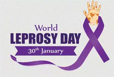 આજે વિશ્વ રક્તપિત્ત દિવસઃગાંધીનગર જિલ્લામાં છેલ્લા ત્રણ વર્ષમાં ૬૪ દર્દીઓ | Today is World Leprosy D…