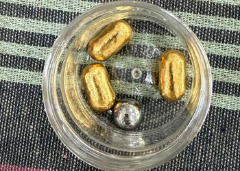 અમદાવાદ એરપોર્ટ પર પેટમાં સોનાની કેપ્સ્યૂલ છુપાવીને લાવનાર યુવક ઝડપાયો, અધિકારીઓ ચોંક્યા | ahmedabad…