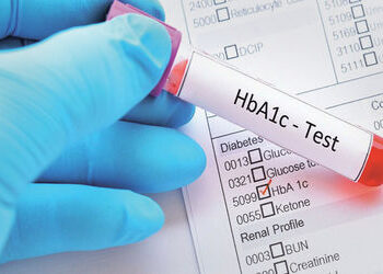 ભારતીયોમાં HbA1c બ્લડ ટેસ્ટના આધારે થતું ડાયાબિટિસનું નિદાન ભૂલભરેલું હોઈ શકે છે | Diagnosing diabet…