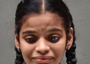 જન્મથી પ્રજ્ઞાાચક્ષુ વિદ્યાર્થિનીએ ધો.10ની બોર્ડ પરીક્ષામાં 93 ટકા માર્કસ મેળવ્યા | blind student ge…