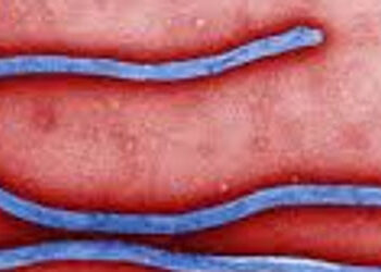 બિઝનેસ ટૂર પર આવેલા યુવકને શંકાસ્પદ ઇબોલા | Suspected Ebola in young man on business trip