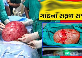ભાવનગરની મહિલાના પેટમાંથી સર્જરી કરી 8 કિલોની ગાંઠ કાઢવામાં આવી | An 8 kg tumor was removed from the…