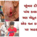 ખૂંખાર દીપડો પાંચ કલાકમાં ત્રણ ખેડૂત અને એક વન કર્મચારી પર ત્રાટક્યો | A ferocious leopard attacked …